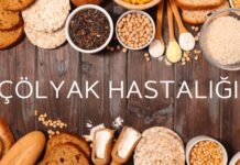 Schär’ın Sertifikalı Çölyak Eğitimi Türkiye’de Bir İlk Oldu colyak hastaligi